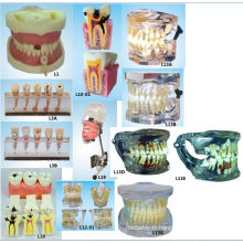 Matériel de l&#39;éducation en sciences orales Modèle de remplissage du canal racinaire Modèle modèle des dents dentaires